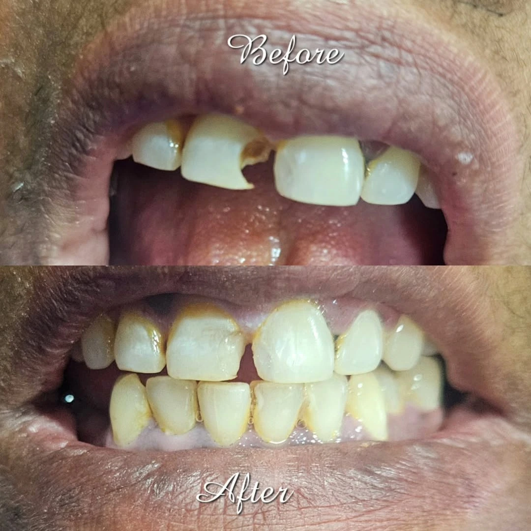 Smile Transformation 8