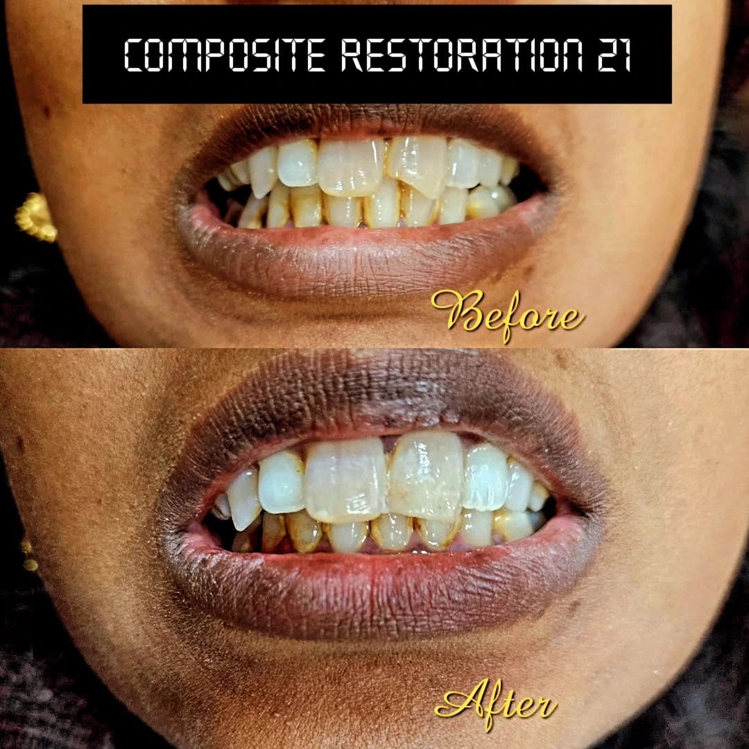 Smile Transformation 10