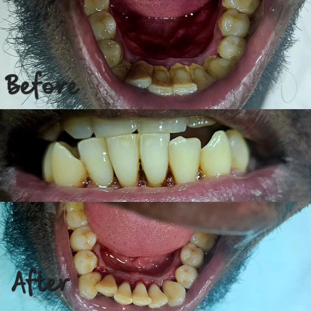 Smile Transformation 12